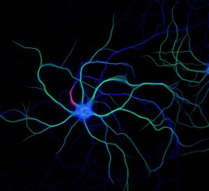 multi-colored hippocampal neuron