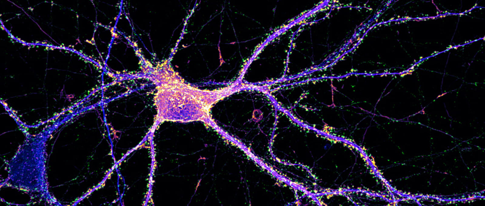 Neurone d'hippocampe étiqueté pour l'actine (orange), la synapsine (vert) et map2 (bleu).