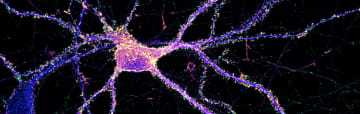 Neurone d'hippocampe étiqueté pour l'actine (orange), la synapsine (vert) et map2 (bleu).